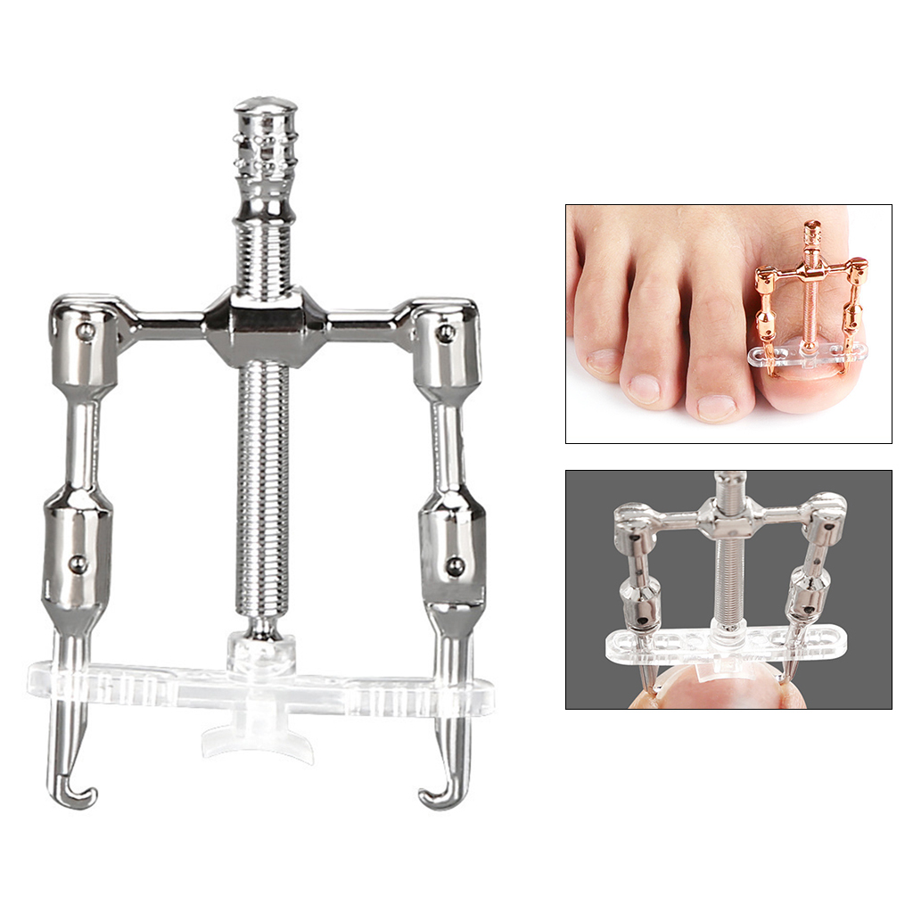 Stainless Steel Mini Toe Nail Corrector Correction for Foot Ingrown Toenail