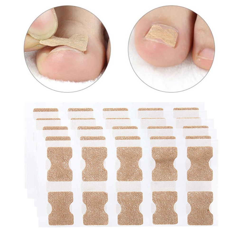 Pack 50 Ingrown Toenail Corrector  Treatment Tape Foot Nail Care