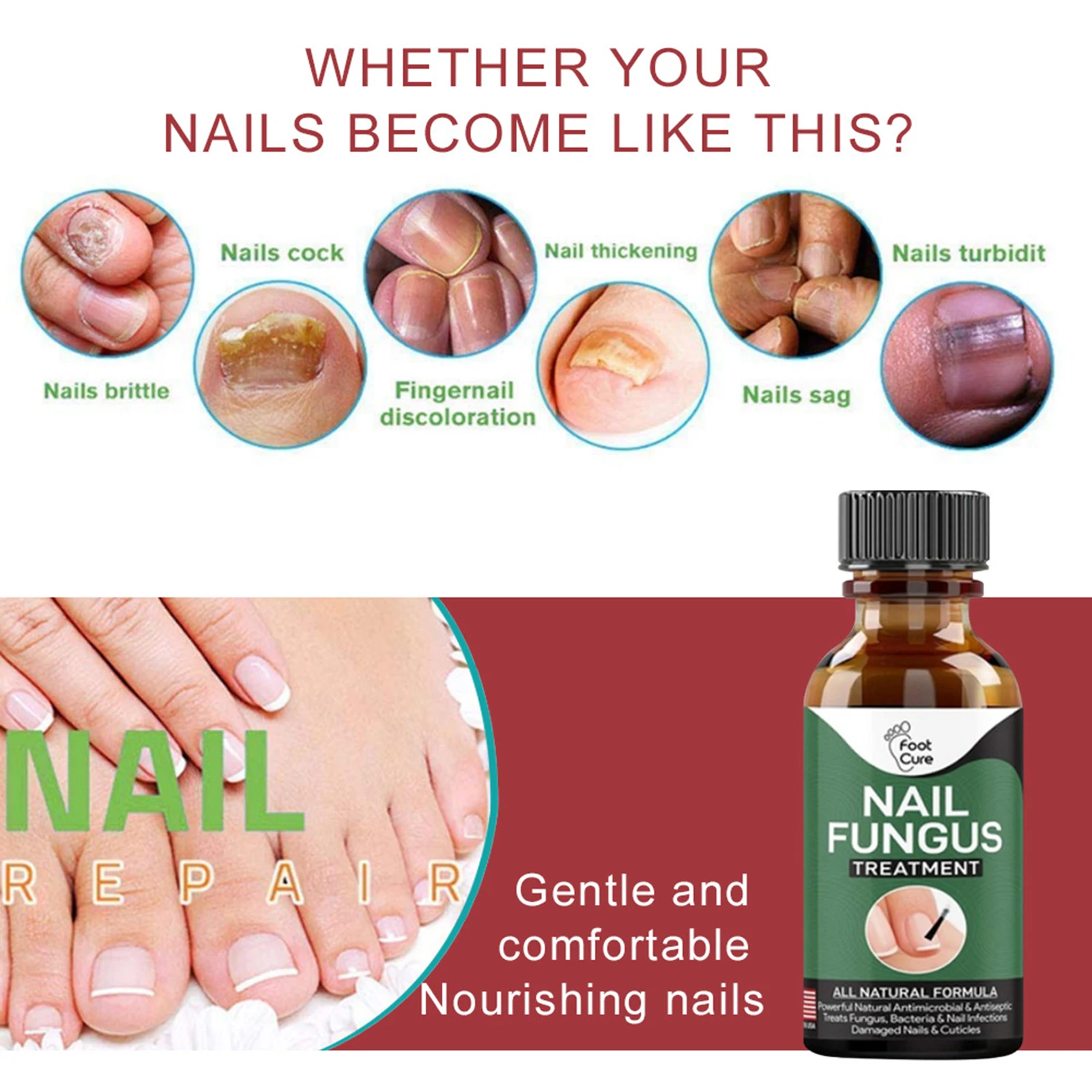 Toe Fungal Nail Essences Treatment Antifungal Repair Gel Nail Pedicure Tool