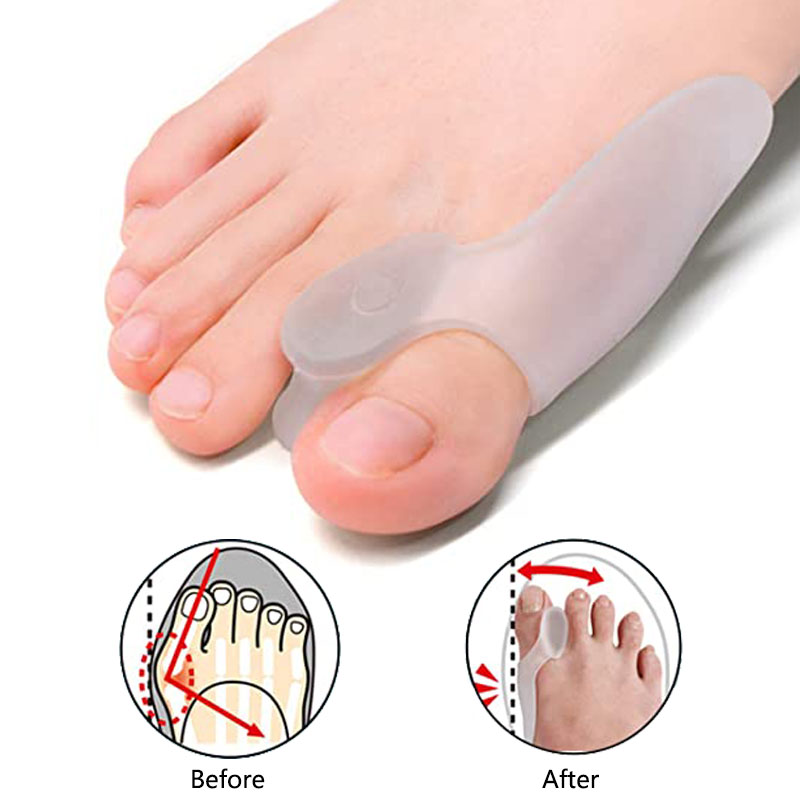 Best of 2pcs Hallux Valgus Corrector Pad Silicone Finger Toe Separator Relieve Bunion Pain Big Toe Straightener Adjuster Foot Care Tool Reviews & Tips