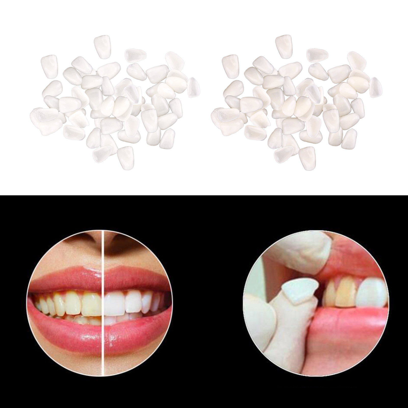 Ultra-Thin  Temporary Crown Ultra Thin Resin Whitening Teeth Upper Anterior Shade Tooth Veneers Oral Care Tool