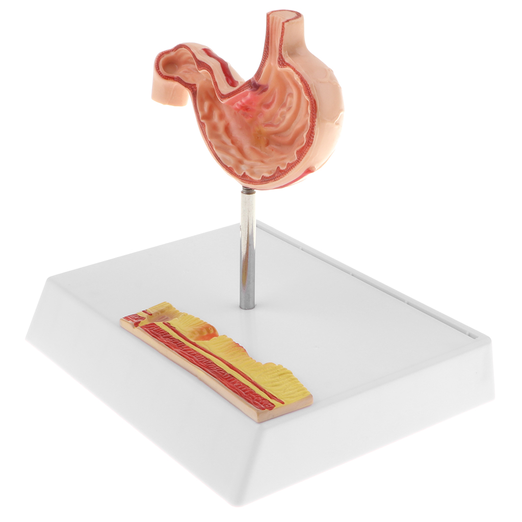 1: 1 Human Stomach Model with Detailed Illustrations, Anatomy
