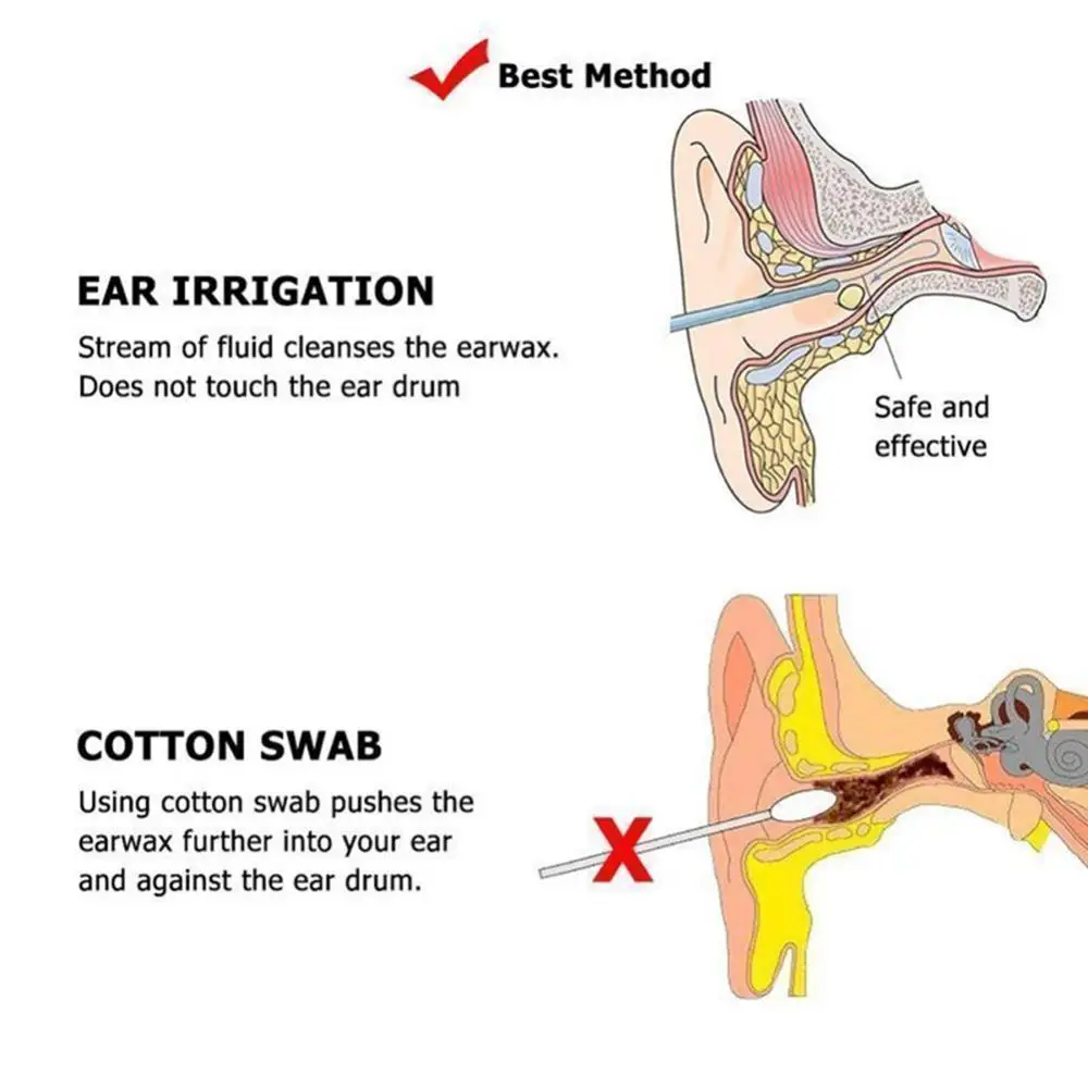 Ear Cleaning Irrigation Kit para adultos e