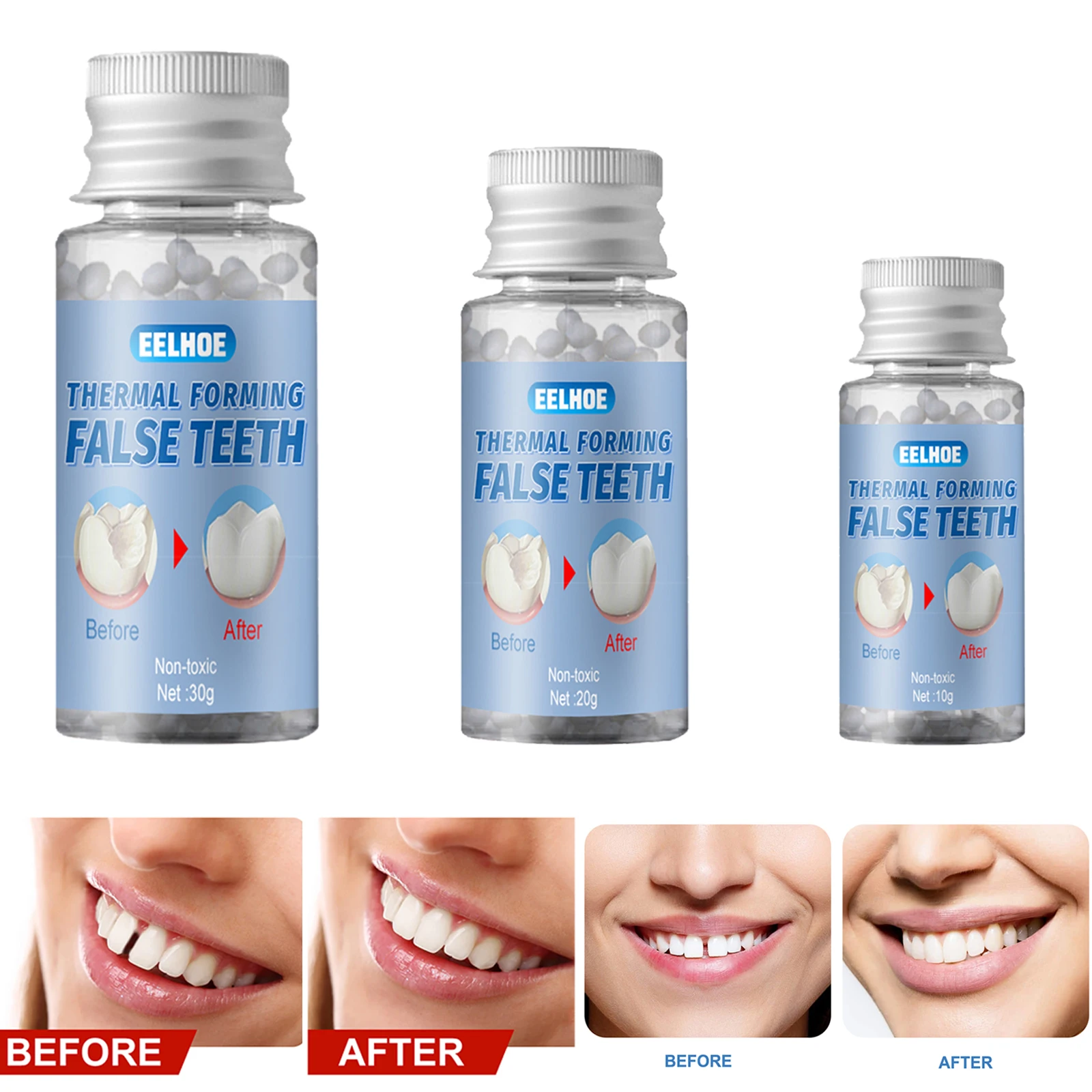 1Bottle Thermal Fitting Beads Teeth Veneers Moldable Temporary Tooth Repair Kit for Fix the Missing Tooth Teaching