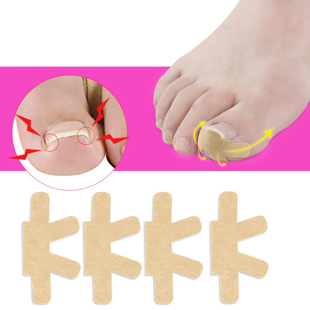 4 Pc Ingrown Toenail Corrector Stickers Patch Corrector Pedicure Tools Nail Care
