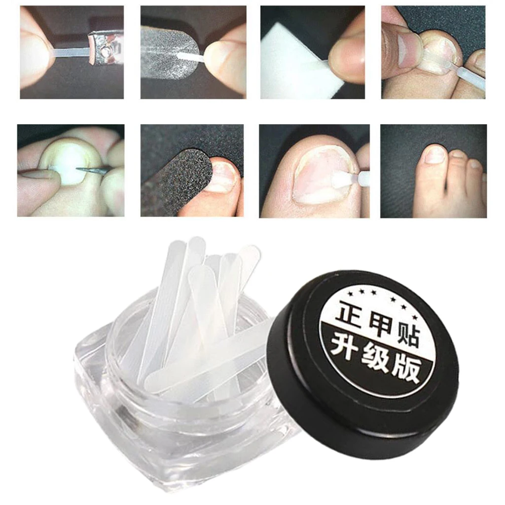 10Sheets Clear Ingrown Toenail Patch Correction Treatment Tape Pain Ease