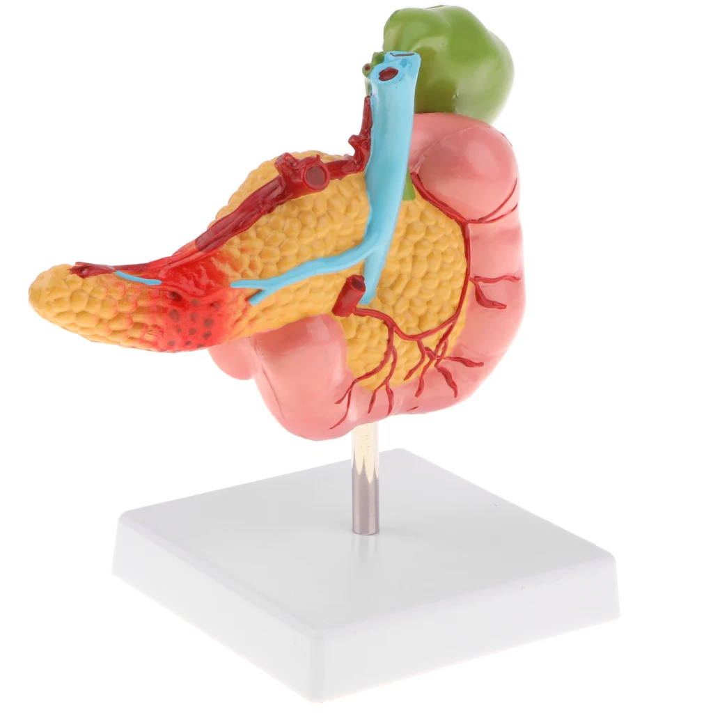 Lifesize Human Pancreas Duodenum Gallbladder Pathological Model with Blood