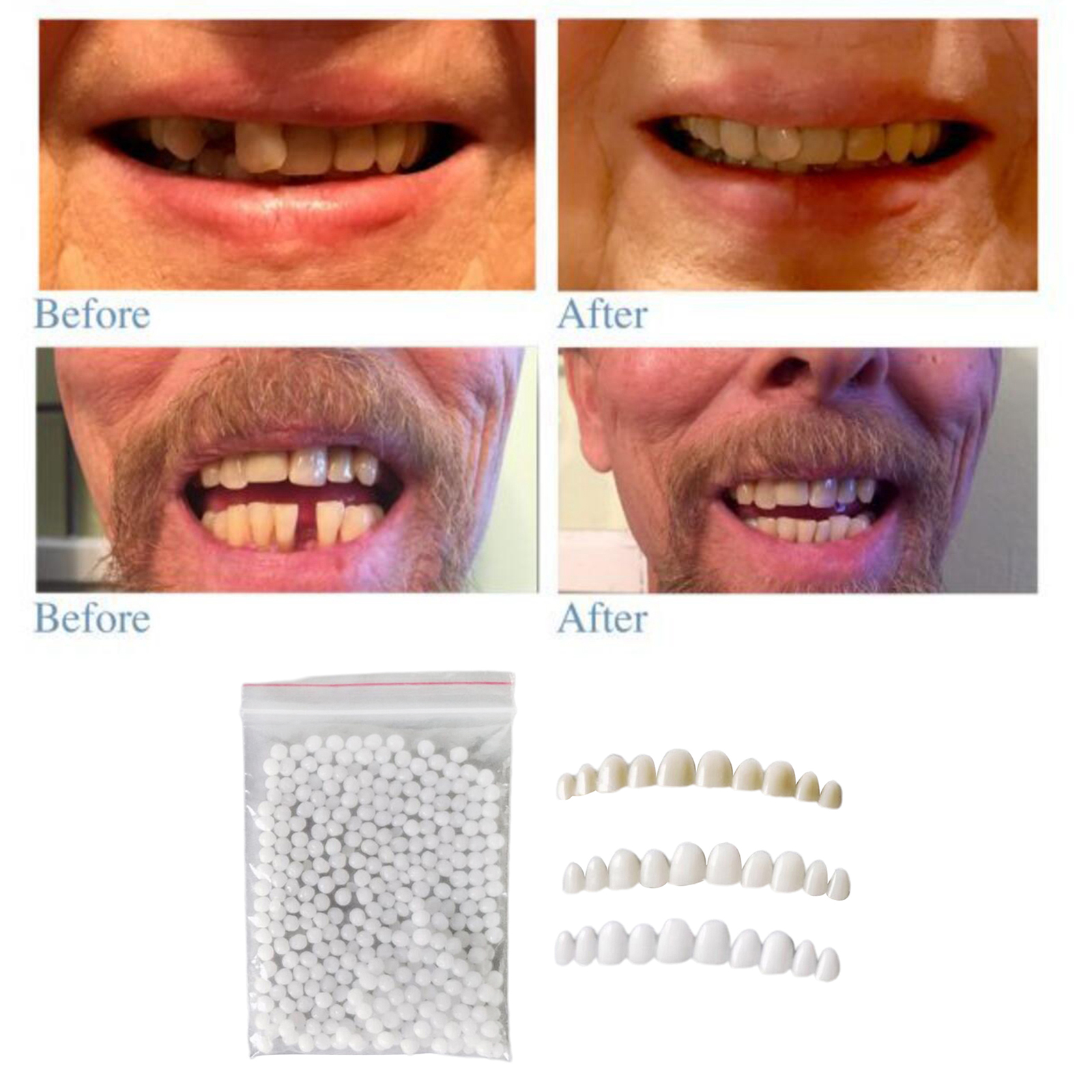 3pcs Soft Moldable Reusable Teeth Veneers with Fitting Beads for Men Women Temporary Teeth Confidence 