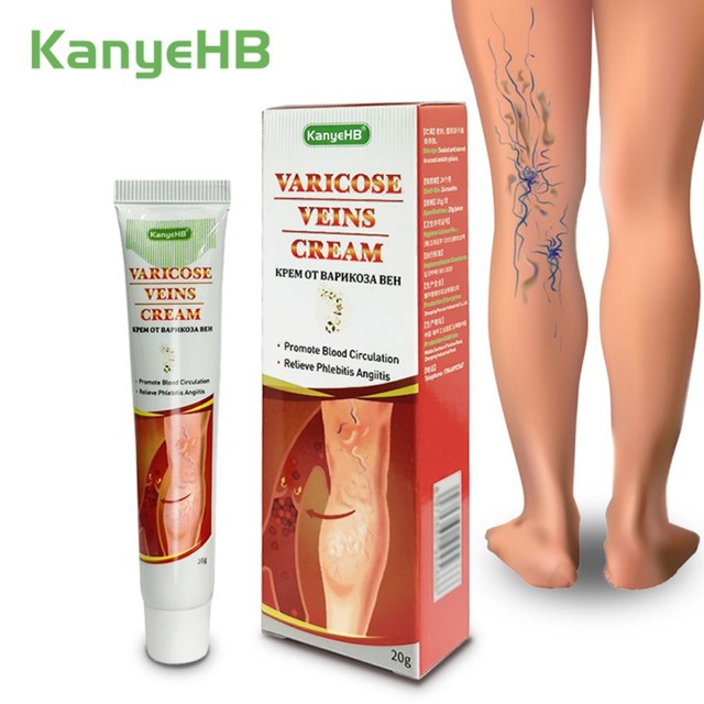 Varicose Veins Cream For Legs Veins Treatment Relief Inflammation