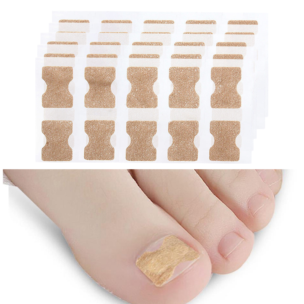 Pack 50 Ingrown Toenail Corrector  Treatment Tape Foot Nail Care