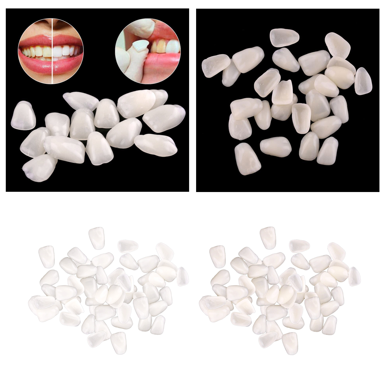Ultra-Thin  Temporary Crown Ultra Thin Resin Whitening Teeth Upper Anterior Shade Tooth Veneers Oral Care Tool