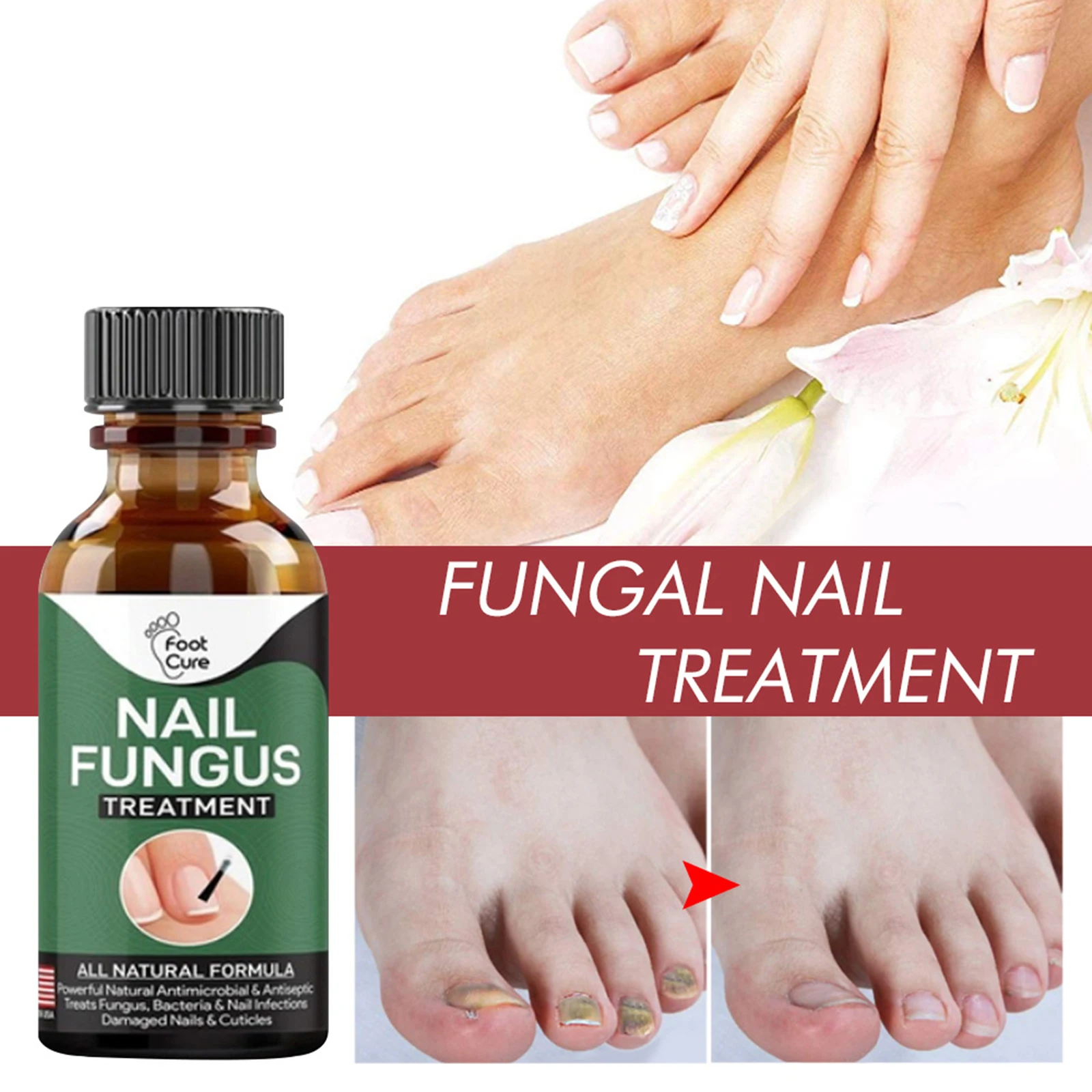 Nail Repair Nail treatment onychomycosis treatment net: 10g. Ноги в масле. Лучшее противогрибковое средство для ногтей на ногах.