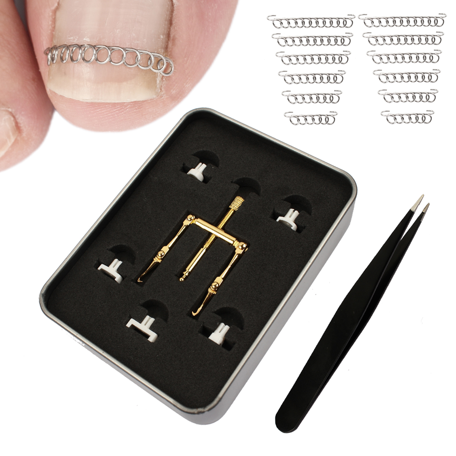 Ingrown Toenail Treatment Kit Corrector Fixer Recover Toe Nail Lifter Clamp Tweezer Wire Foot Pedicure Tool for Paronychia