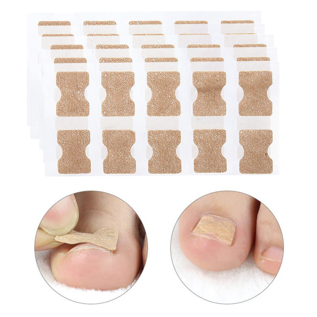 Pack 50 Ingrown Toenail Corrector  Treatment Tape Foot Nail Care