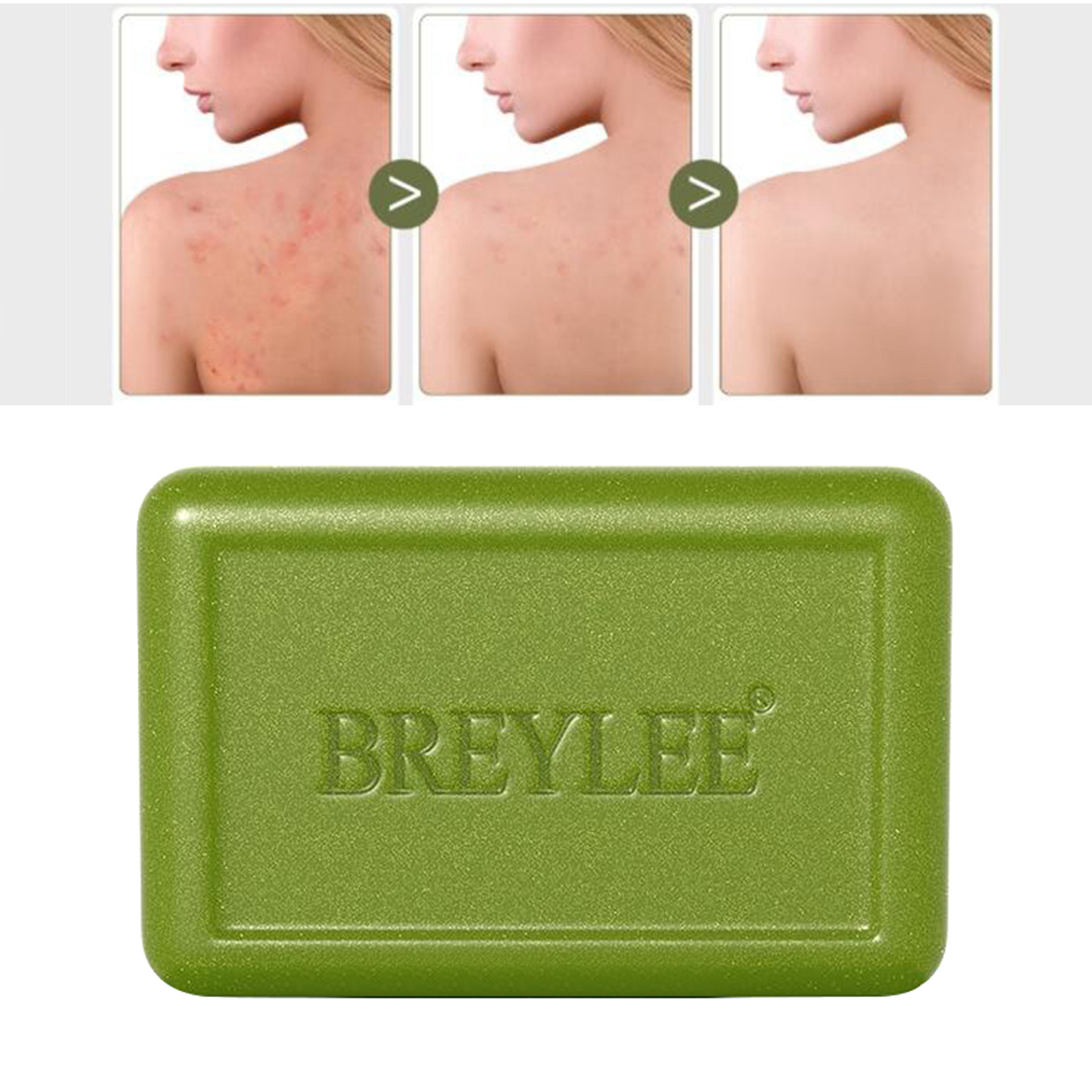 BREYLEE Soap Bar Oil Face  Treatment Whitening Soap Bath Deep Cleansing