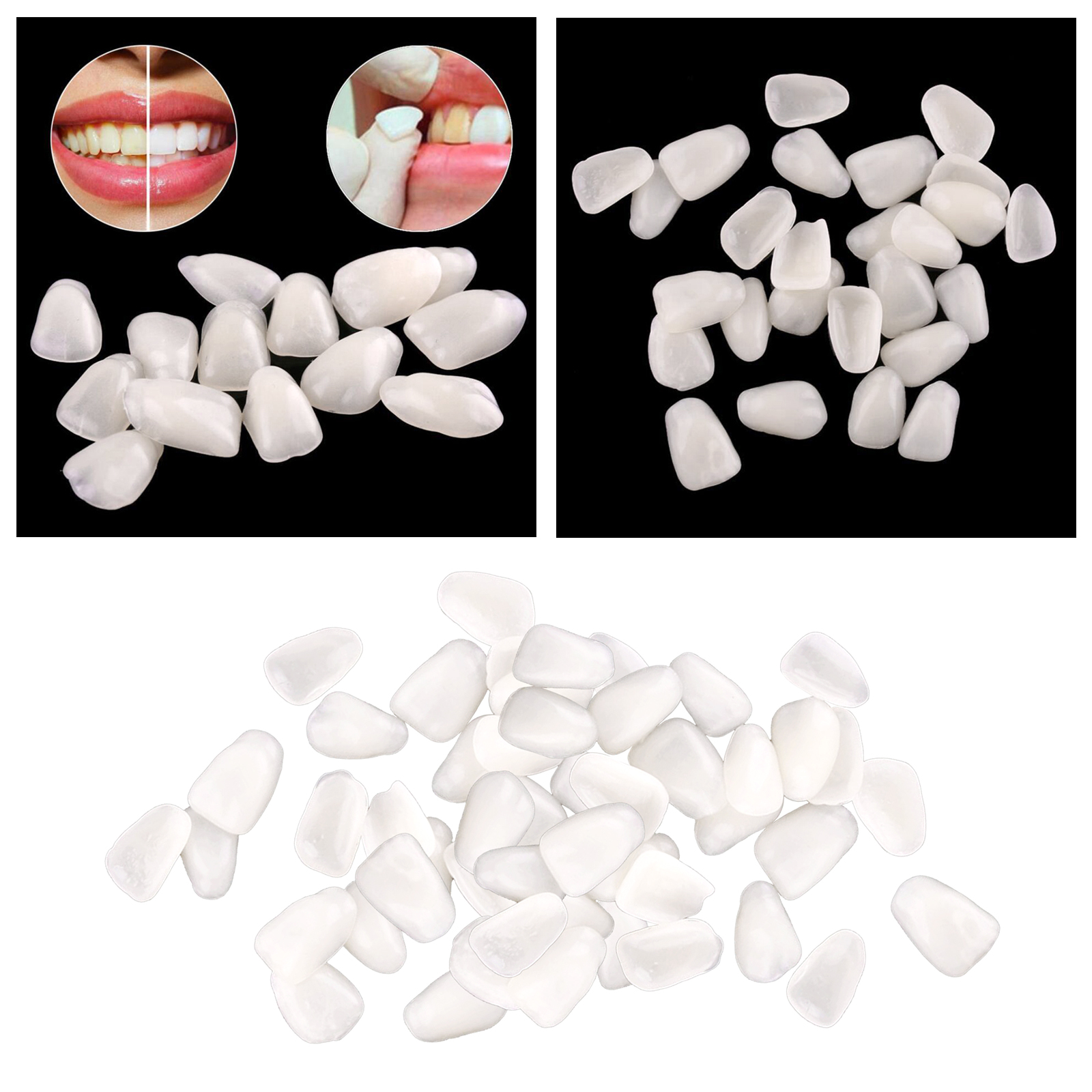 Ultra-Thin  Temporary Crown Ultra Thin Resin Whitening Teeth Upper Anterior Shade Tooth Veneers Oral Care Tool