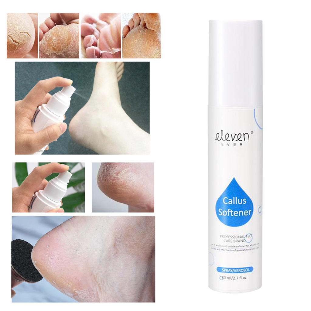 Foot Callus Remover Sprayer, Works well with foot scrubber, file, pumice stone