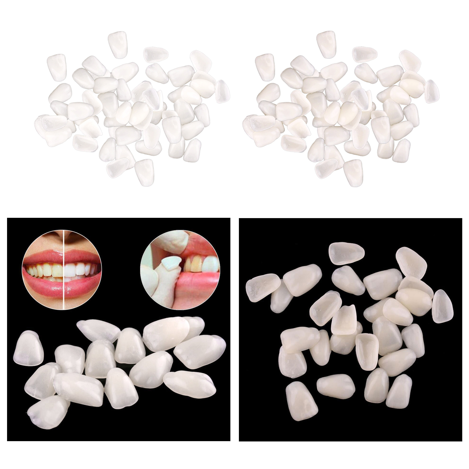 Ultra-Thin  Temporary Crown Ultra Thin Resin Whitening Teeth Upper Anterior Shade Tooth Veneers Oral Care Tool
