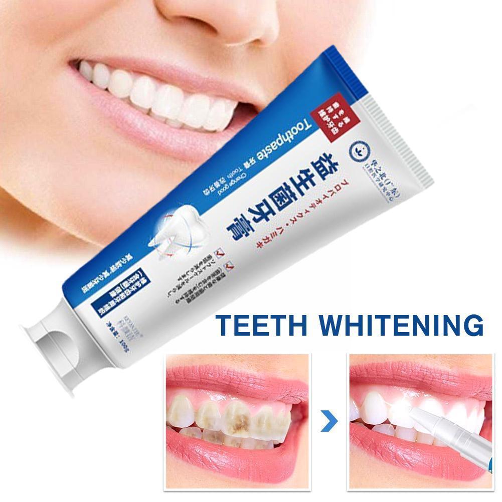 Best of 100g Repair Of Cavities Caries Repair Teeth Plaque Yellowing Decay Whitening Repair Stains Whitening Teeth Teeth M1H5 Reviews & Tips