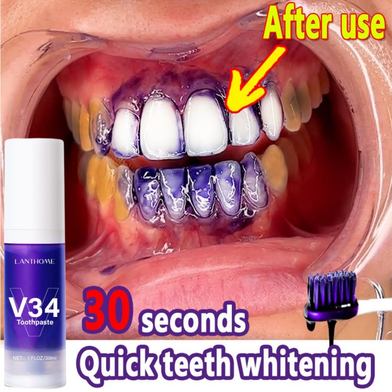 Best of V34 Teeth Whitening Mousse Pro Purple Brighten Corrector Toothpaste Remove Plaque Stain Easy Smile Fresh Breath Clean Teeth Care Reviews & Tips