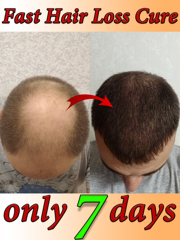 Best of Fast Hair Growth Essential Oils Serum Products Anti Effective Baldness Reviews & Tips