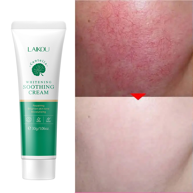 Best of Effective Treatment Face Redness Cream Repair Nourish Sensitive Skin Care Improve Acne Fade Acne Scars Whitening Korea Cosmetic Reviews & Tips