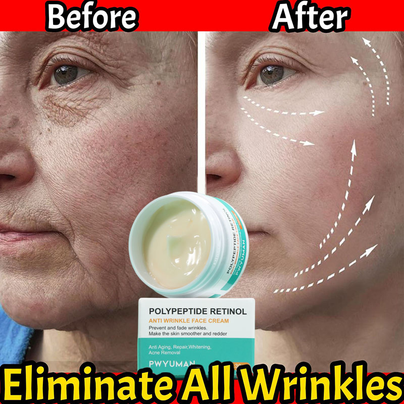 Best of Anti Wrinkle Cream For Face Instant Effect Wrinkle Removal Face Cream Anti-Aging Improve Fine Lines Nourishing Skin Care 30g Reviews & Tips