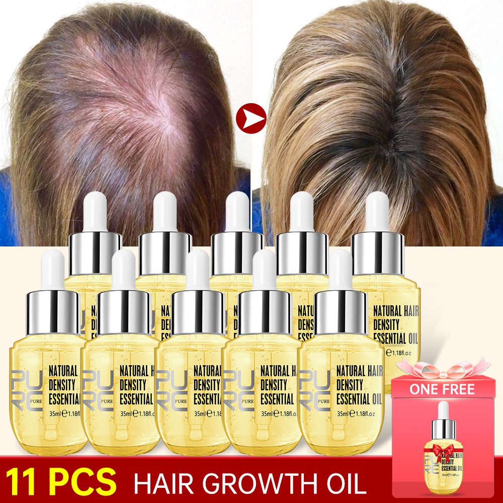 Best of PURC 10PCS Hair Growth For Men Women Products Ginger Hair Oil Fast Grow Serum Anti Loss Regrowth Scalp Treatment Hair Care Reviews & Tips