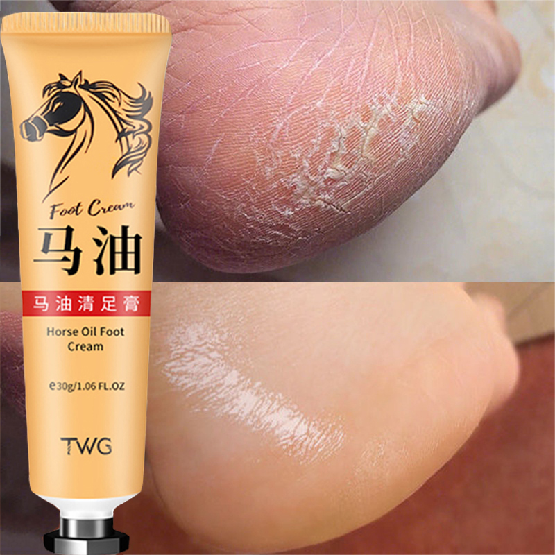 Best of Anti Crack Foot Cream Heel Cracked Repair Horse Oil Cream Smooth Removal Dead Skin Callus Anti-Drying Hand Feet Skin Care 30g Reviews & Tips