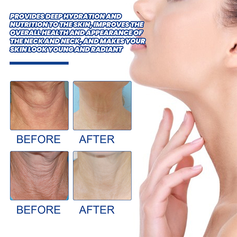 Best of Neck Lines Protein Cream Moisturis Nourish Lift Neck Eliminate Double Chin Eliminate Neck Fine Lines Anti-ageing Rejuvenation Reviews & Tips - Image 2