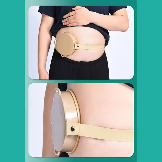 Childrens Stoma Protector - Children & Toddler Stoma Belt