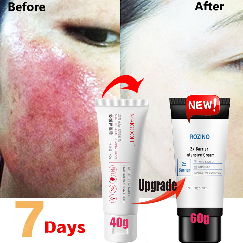 Best of Facial Redness Repair Cream Improve Sensitive Skin Redness Rosacea Itching Anti Aging Moisturizer Sooth Korean Care Cosmetics Reviews & Tips