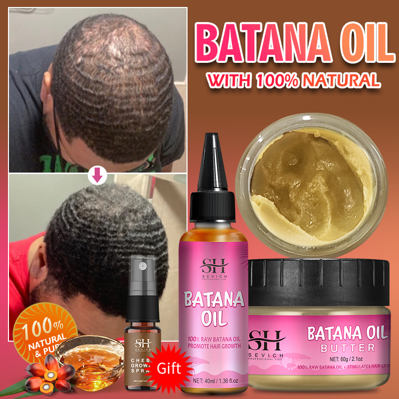 Best of Natural 100% Pure Batana Growth Oil Set For Traction Alopecia Hair Mask Anti Break Loss Hair Growth Oil Baldness Treatment Reviews & Tips