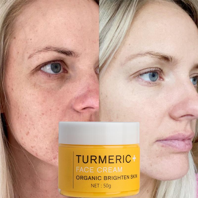 Best of Turmeric Whitening Face Cream Anti Aging Facial Serum Control Pore Shrink Remove Dark Spots Essence Moisturizing Brighten Skin Reviews & Tips