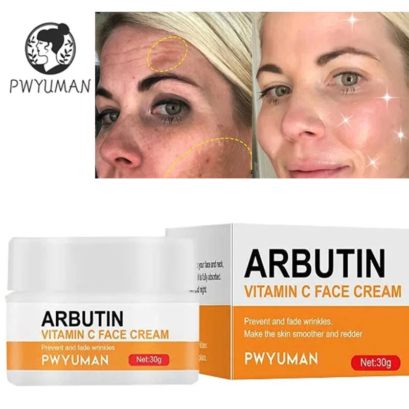 Best of Vitamin C Whitening Freckles Face Cream Remove Melasma Melanin Fade Dark Spot Acne Marks Brighten Moisturizing Firming Skin Care Reviews & Tips