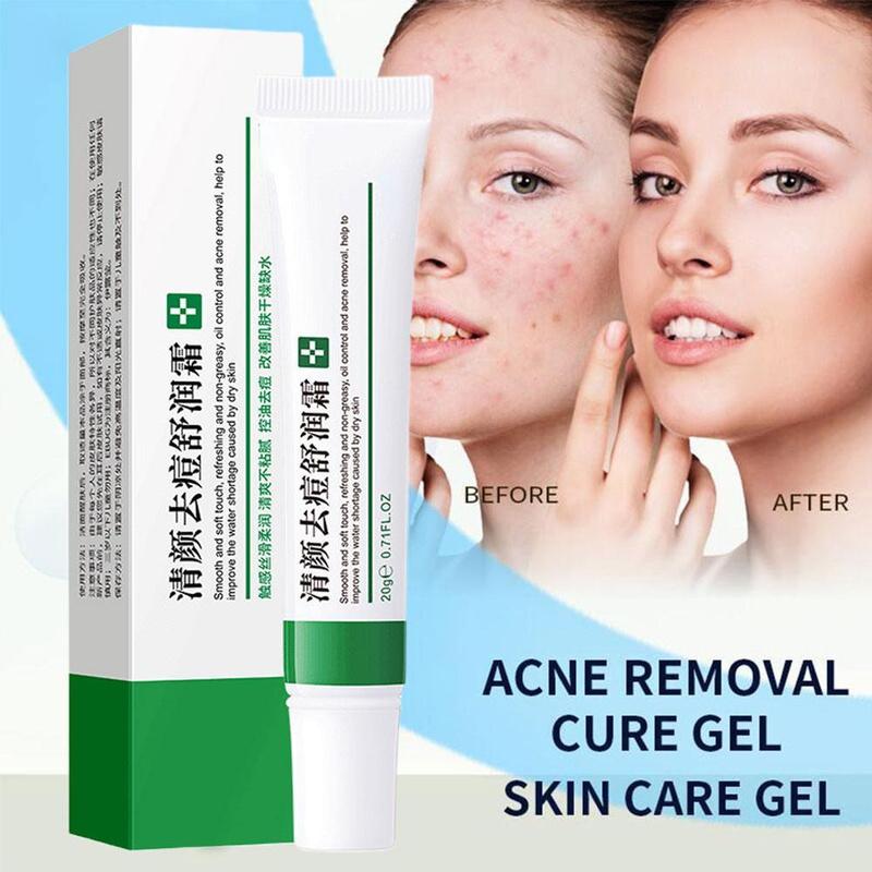 Best of Acne Removal Cream Freckle Cream Shrink Pores Whitening Moisturizing Oil Control Acne Cream Skin Care Acne Treatment Face Cream Reviews & Tips