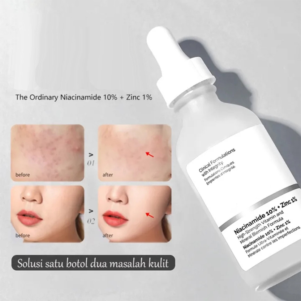 Best of Original Niacinamide 10% + Zinc 1% Serum 30ml Reduce Defects Relieve Congestion Symptoms Brighten And Even Tone Repair Barrier Reviews & Tips