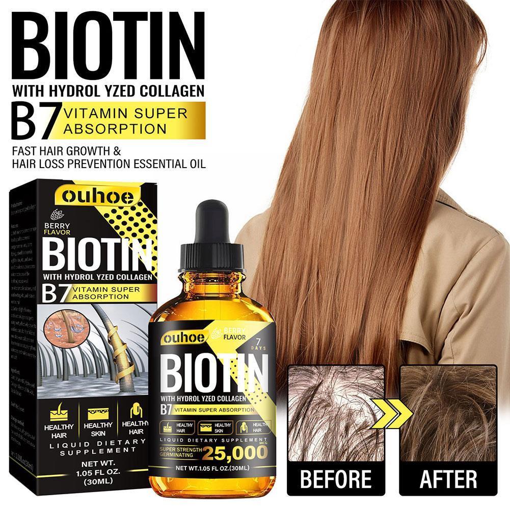 Best of 2023 Biotin Fast Oil Hair Regrowth Serum Hair Thinning Treatment Liquid Anti-hair Loss For Women Men Reviews & Tips