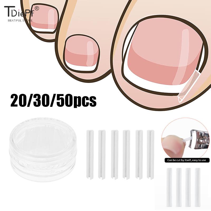 Best of 20 / 30 / 50Pc Toenail Straightening Clip Ingrown Toenail Correction Nail Treatment Elastic Patch Sticker Foot Care Pedicure Tool Reviews & Tips