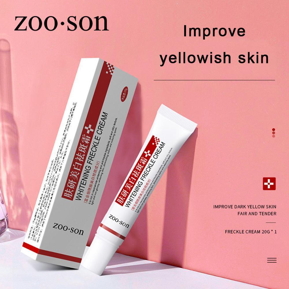 Best of Face Skin Care Whitening Freckles Cream Remove Melasma Dark Spots Lighten Remover Moisturizing Brightening 20ml Reviews & Tips