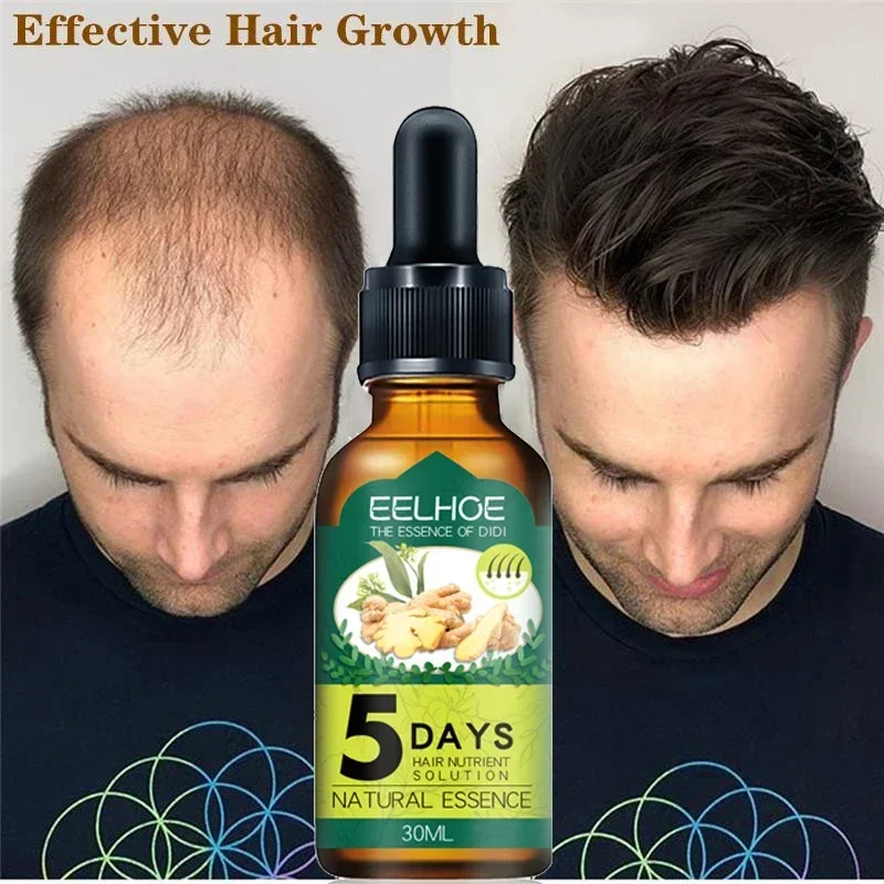 Best of 5 Days Ginger Fast Hair Growth Essential Oil Natural Anti Hair Loss Prevent Baldness Treatment Fast Growing Nourish Dry Damaged Reviews & Tips