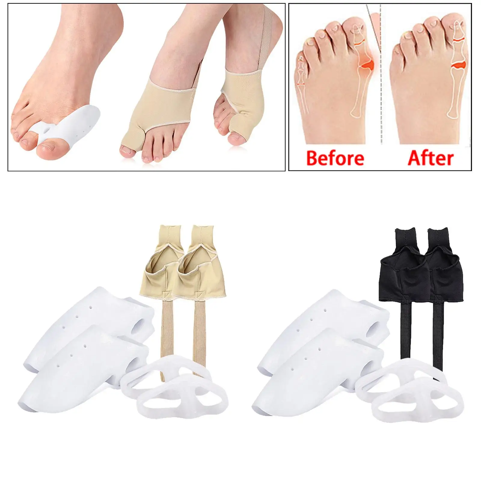 Bunion Corrector Kit Toe Splitter Toe Straightener Improves Toe Realignment Bunion Pads Sleeves Brace