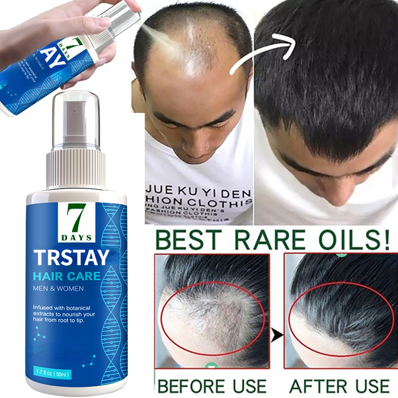 Best of TRSTAY Hair Growth Spray Ginger Hair Grow Hair Essential Oil Treatment Preventing Hair Loss Spray Hair-restorer Reviews & Tips