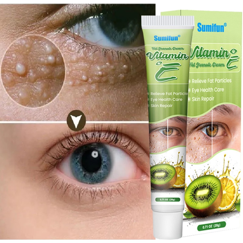 Best of Fat Granules Remover Eyes Cream Improve Eye Bag Fade Fine Lines Moisturizing Anti-Puffiness Lifting Firming Eye Care Products Reviews & Tips