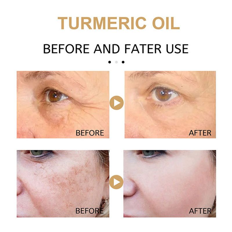 Best of Turmeric Freckle Whitening Serum Fade Dark Spots Removal Pigment Melanin Correcting Facial Beauty Face Skin Care Products 30ml Reviews & Tips - Image 3