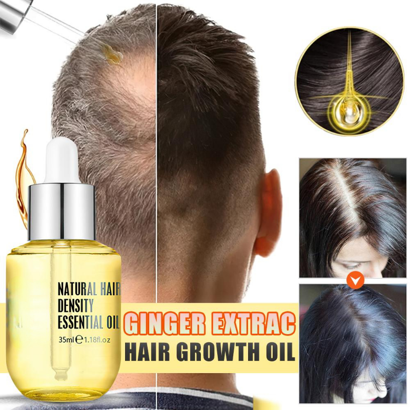 Best of Ginger Essence Hair Growth Products Fast Regrowth Oil Serum Prevent Loss Medicine Care Scalp Treatment Men Women Reviews & Tips