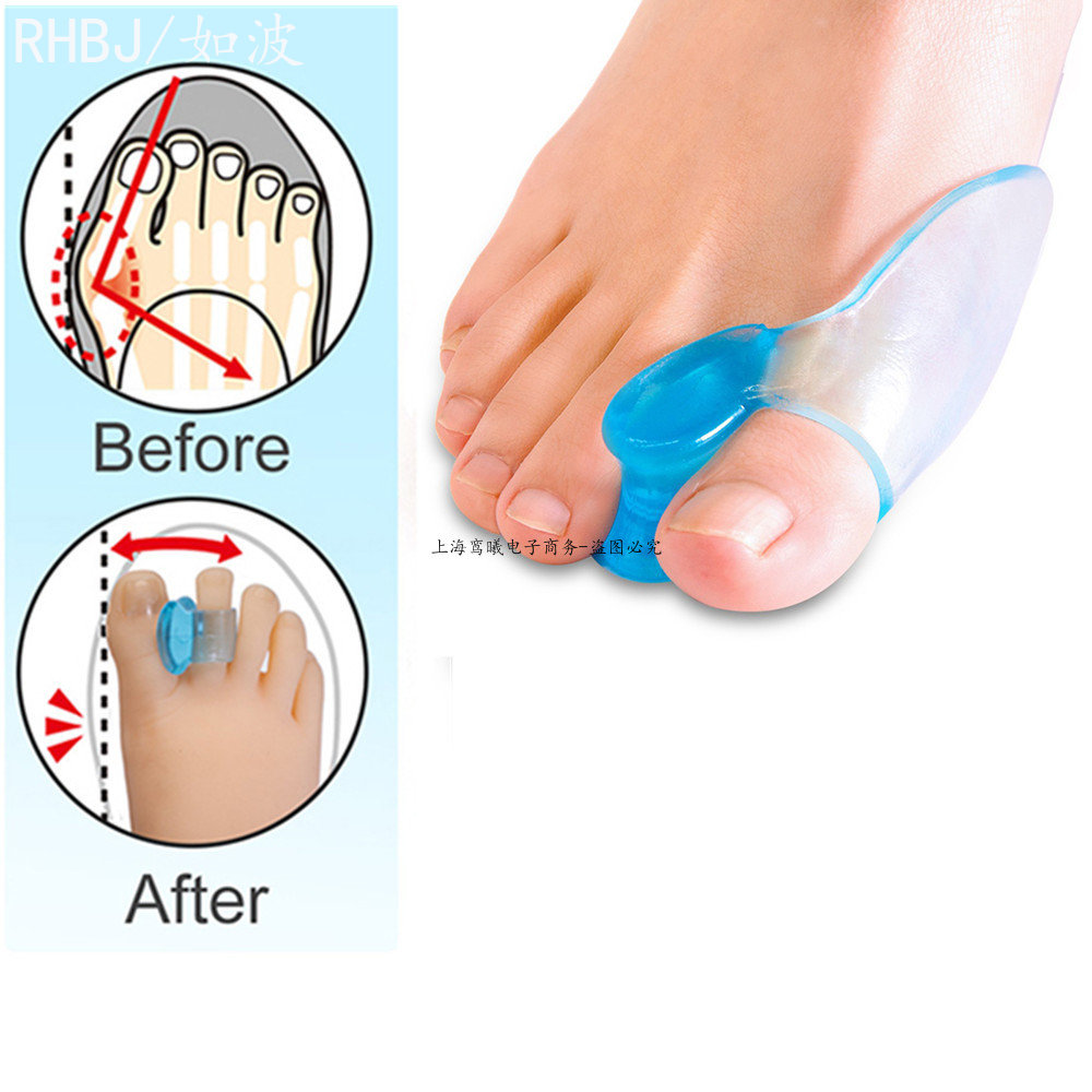 Best of Silicone Gel 2pcs Thumb Corrector Bunion Little Toe Protector Separator Hallux Valgus Finger Straightener Foot Care Relief Pads Reviews & Tips