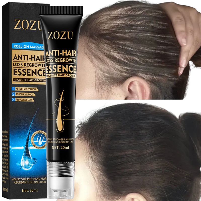 Best of Fast Hair Growth Serum Effective Anti Hair Loss Serum Baldness Repair Hereditary Postpartum Seborrheic Hair Loss Hair Care Reviews & Tips