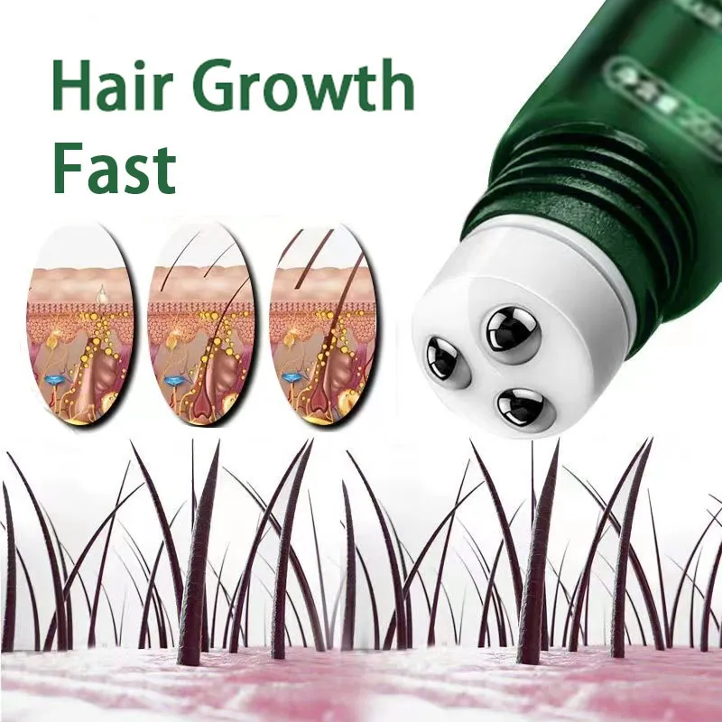 Best of Hair Growth Oil Fast Hair Growth Effective Baldness Repair Hereditary Postpartum Hair Loss Seborrheic Hair Loss Reviews & Tips