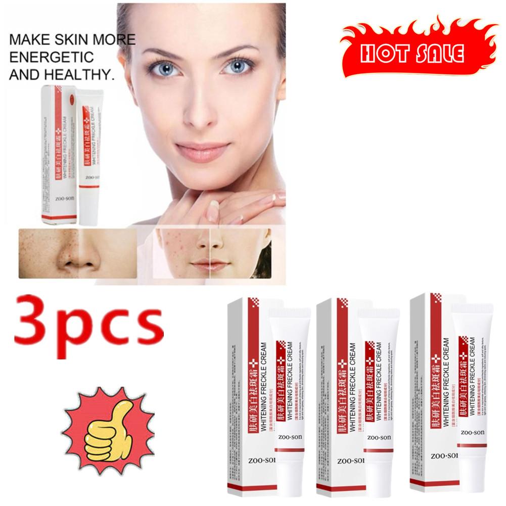 Best of 3PCS Effective Whitening Freckle Cream Remove Dark Spots Anti Freckle Cream Fade Pigmentation Melasma Brighten Creams Skin Care Reviews & Tips